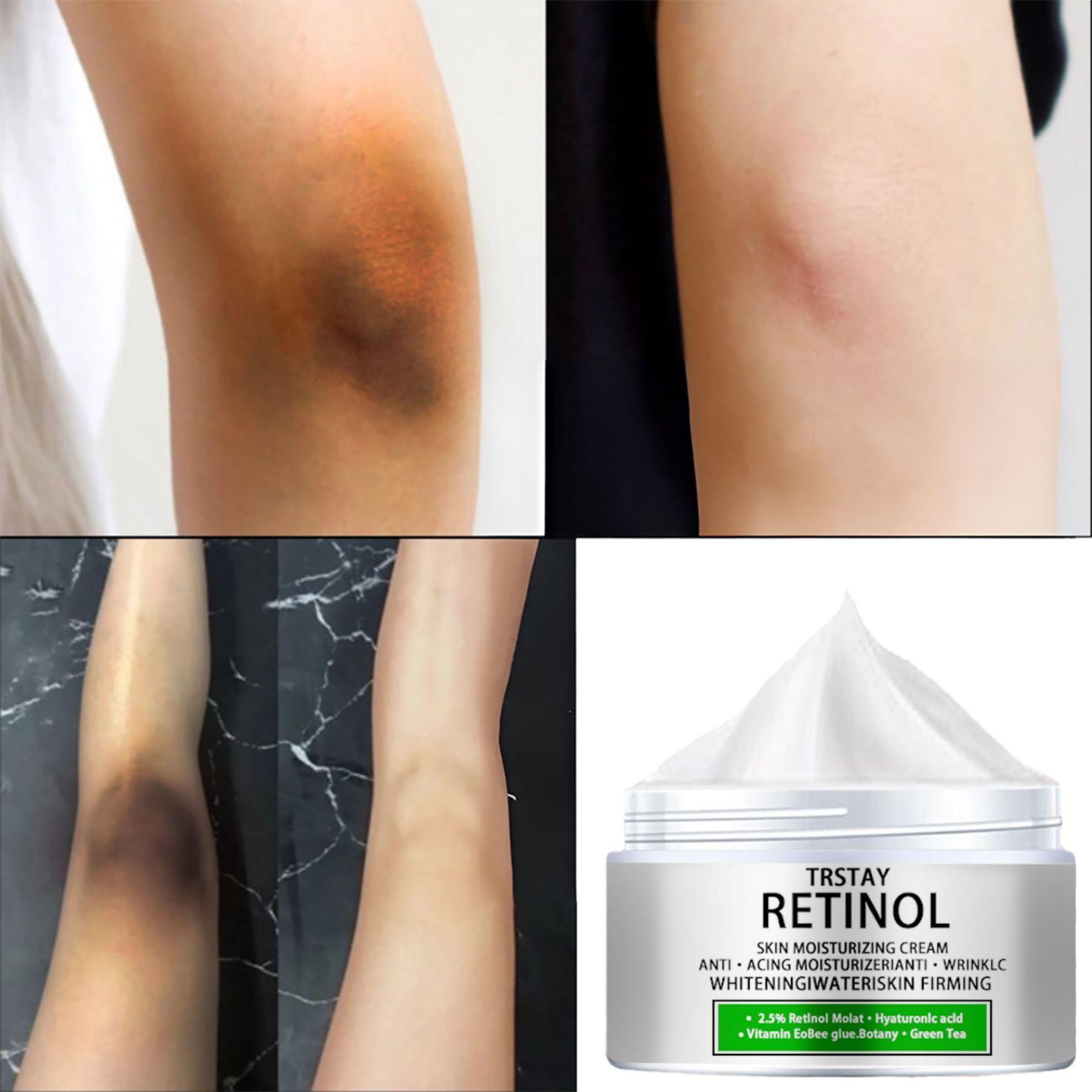 Осветляющий отбеливающий увлажняющий крем, нежный и не раздражающий, увлажняющий, осветляющий тусклость и осветляющий тон кожи